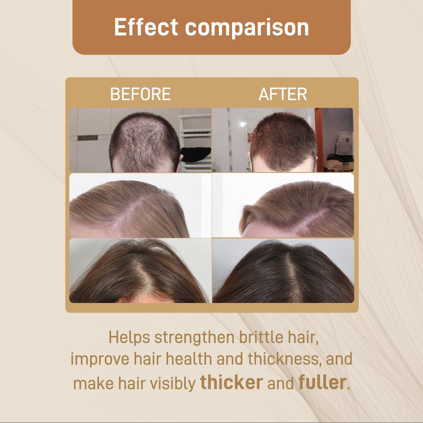 Googeer Dense Hair Dietary Supplement Drops Nourishes Roots, Prevents Breakouts And Strengthens Hair Care Supplements