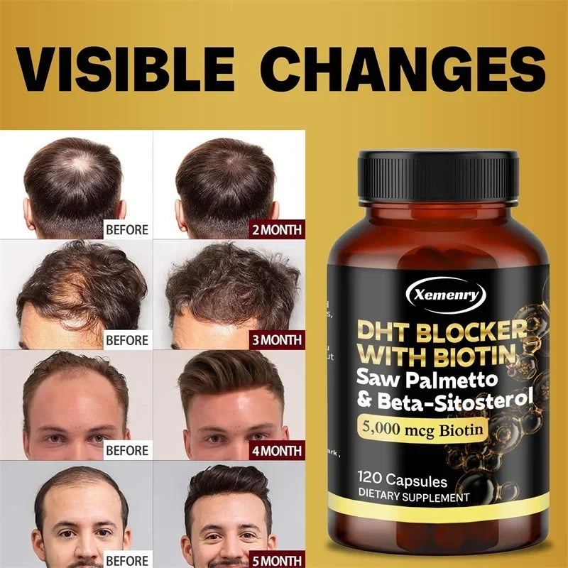 Saw Palmetto Extract Capsules - Prostate Health,Blocker Hair Growth for Mens Help Urination Frequency Supple - 120 Capsules