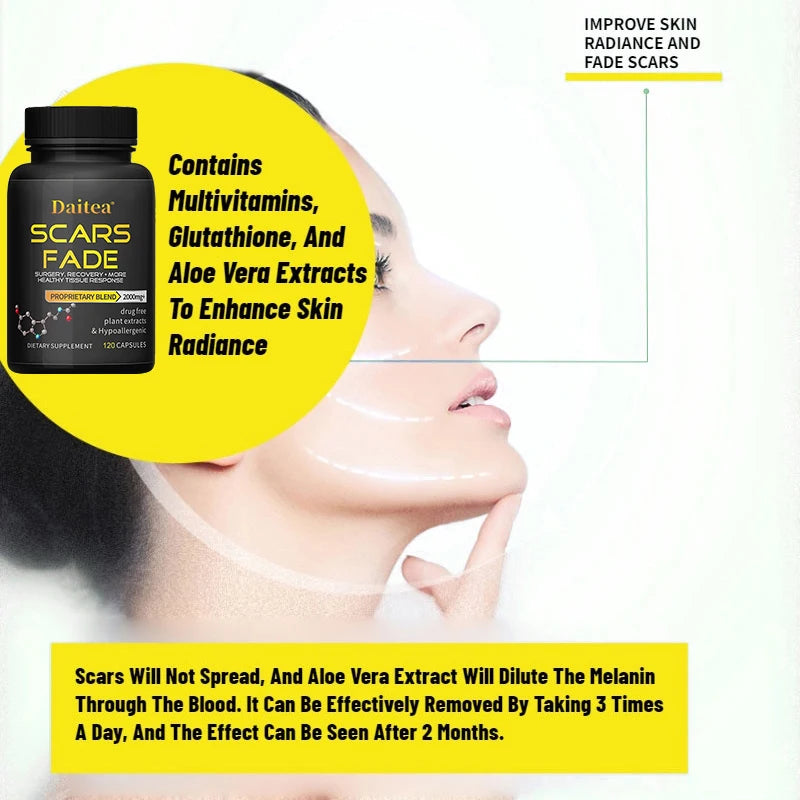 Glutathione Whitening Supplement, Contains Multivitamins, Helps To Lighten Melasma and Acne Scars, Antioxidant