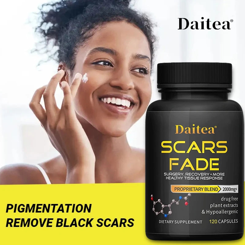 Glutathione Whitening Supplement, Contains Multivitamins, Helps To Lighten Melasma and Acne Scars, Antioxidant